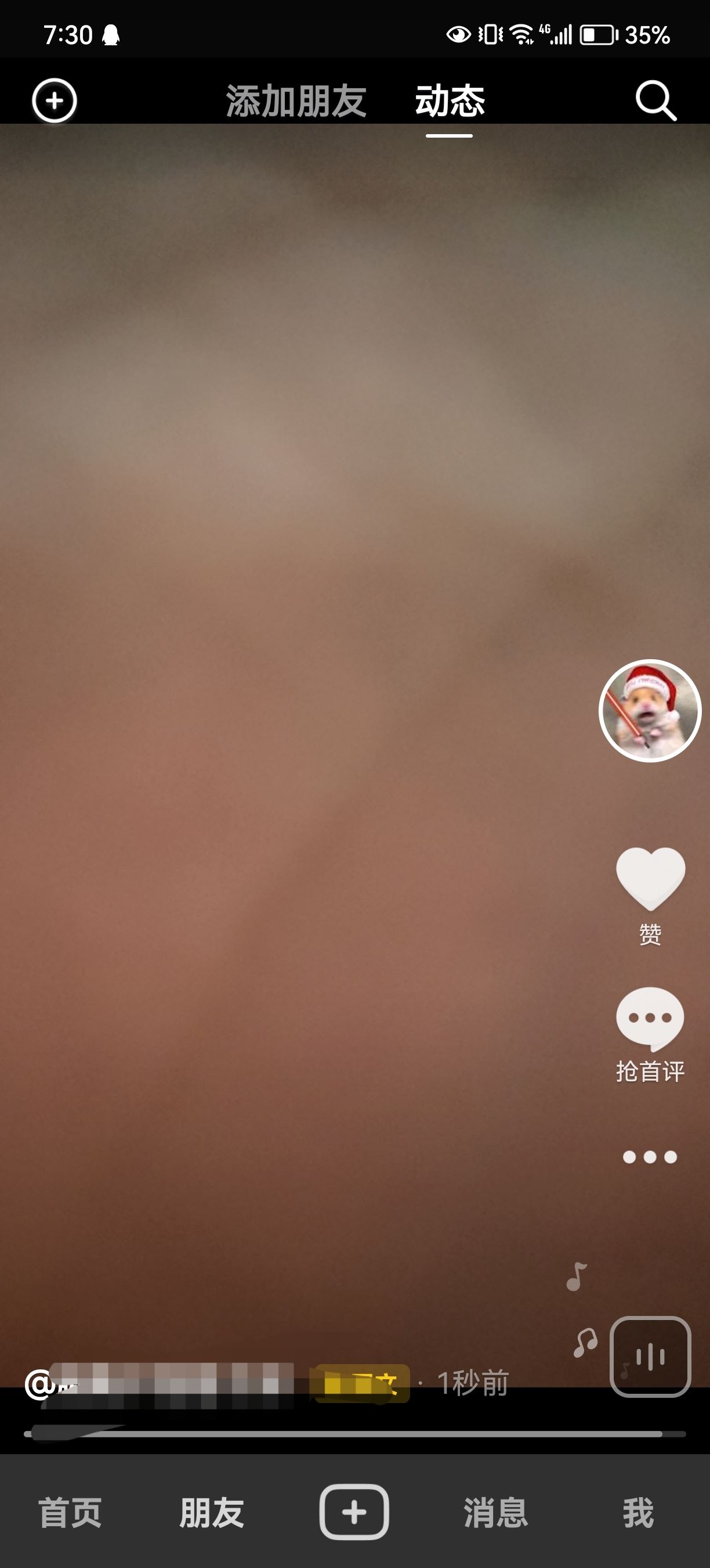 抖音發(fā)的日常怎么轉(zhuǎn)成永久？