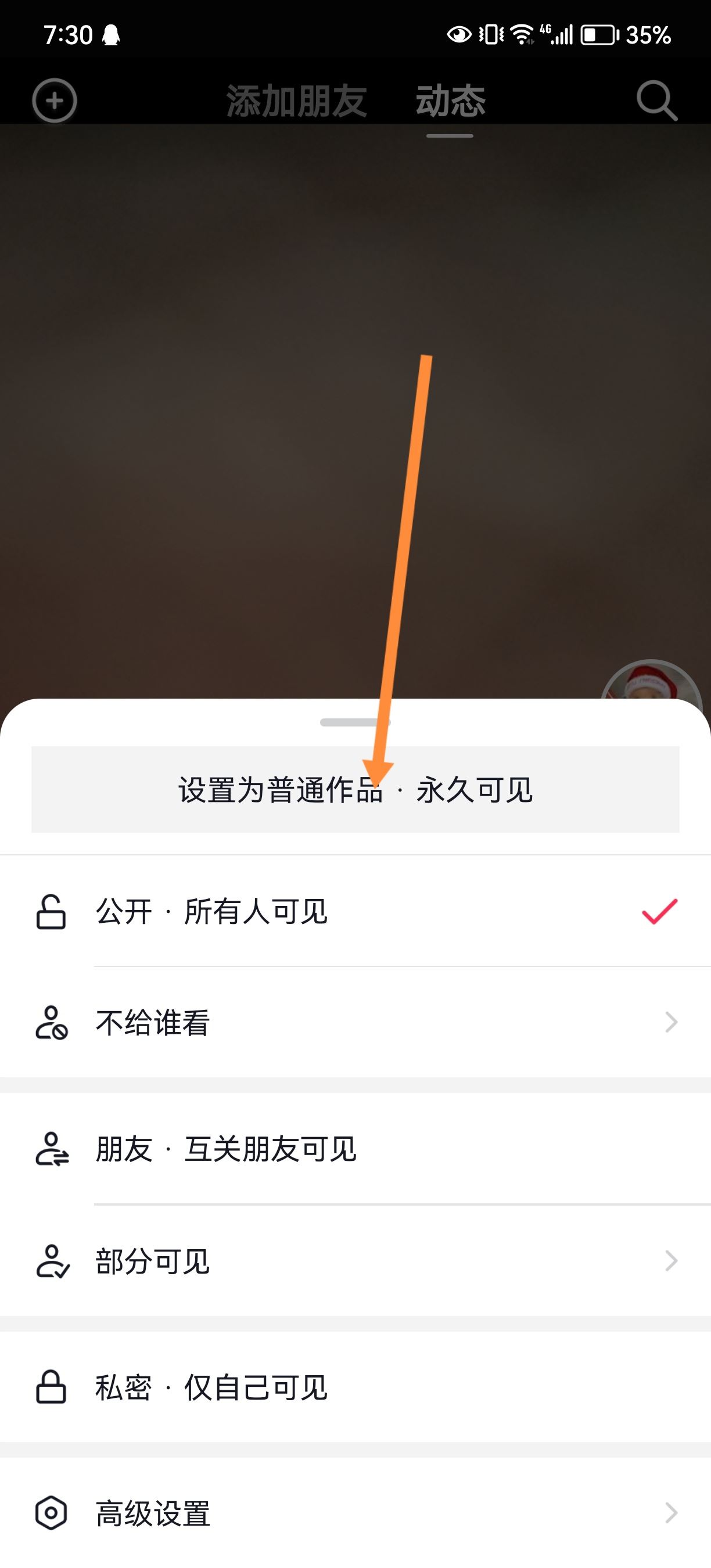 抖音發(fā)的日常怎么轉(zhuǎn)成永久？